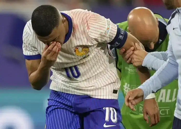 Mbappé sufre una fractura de nariz